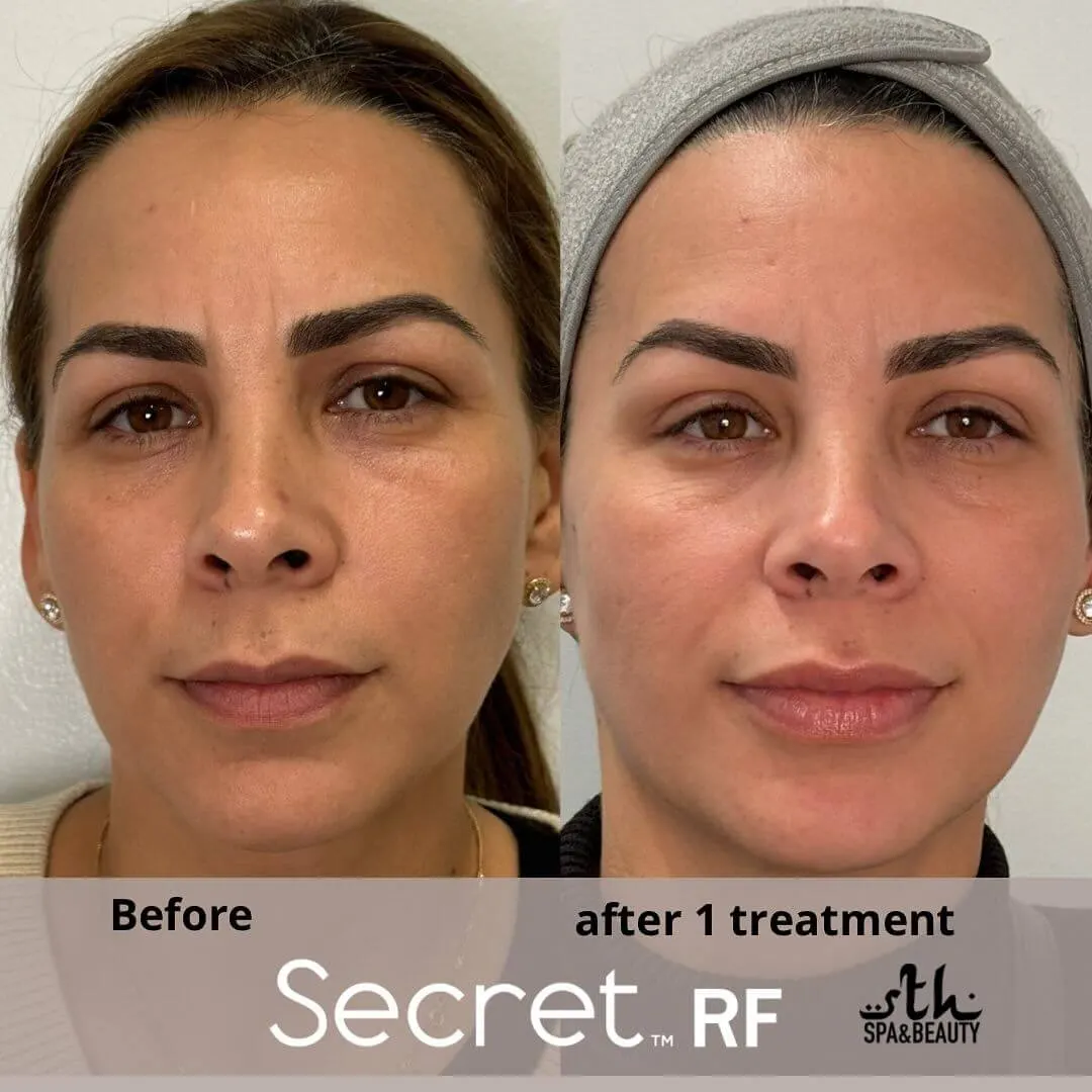 Treatment result