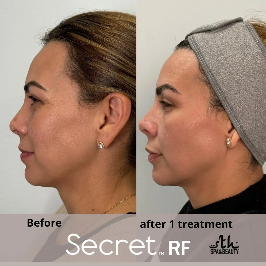Treatment result